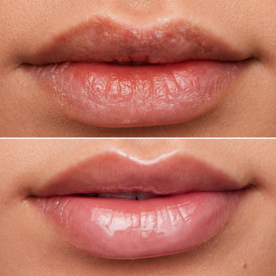 Wonderskin - Lip Rehab Therapy Oil - Clear - Læbepleje 